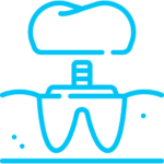 Prothèses dentaires